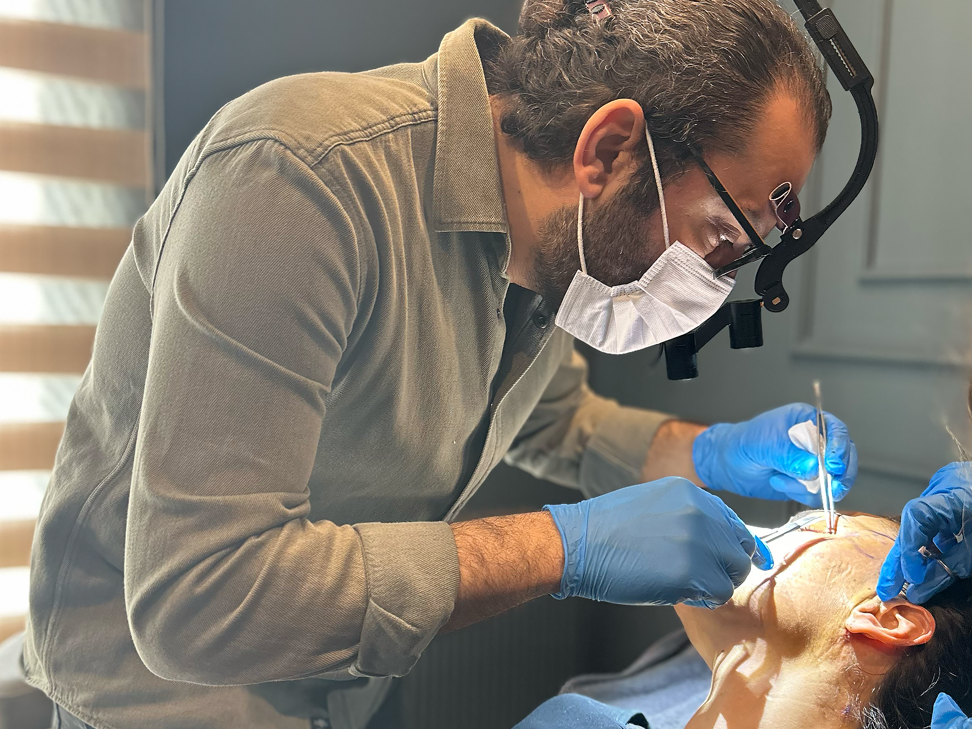 Deep plane facelift Istanbul – before and after Dr. Umut Zereyak